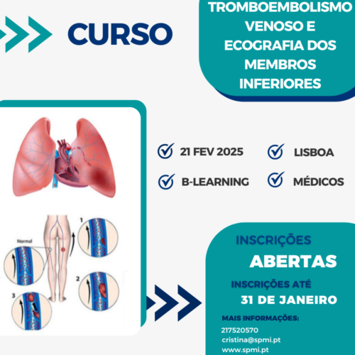 Curso de Tromboembolismo Venoso e Ecografia dos Membros Inferiores para 2025