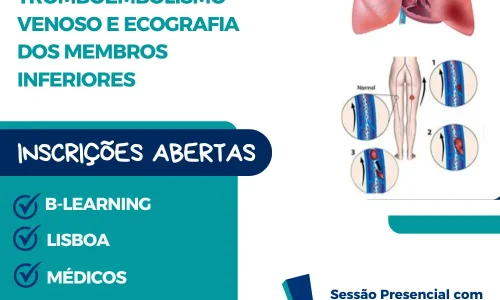 Curso de Tromboembolismo Venoso e Ecografia dos Membros Inferiores